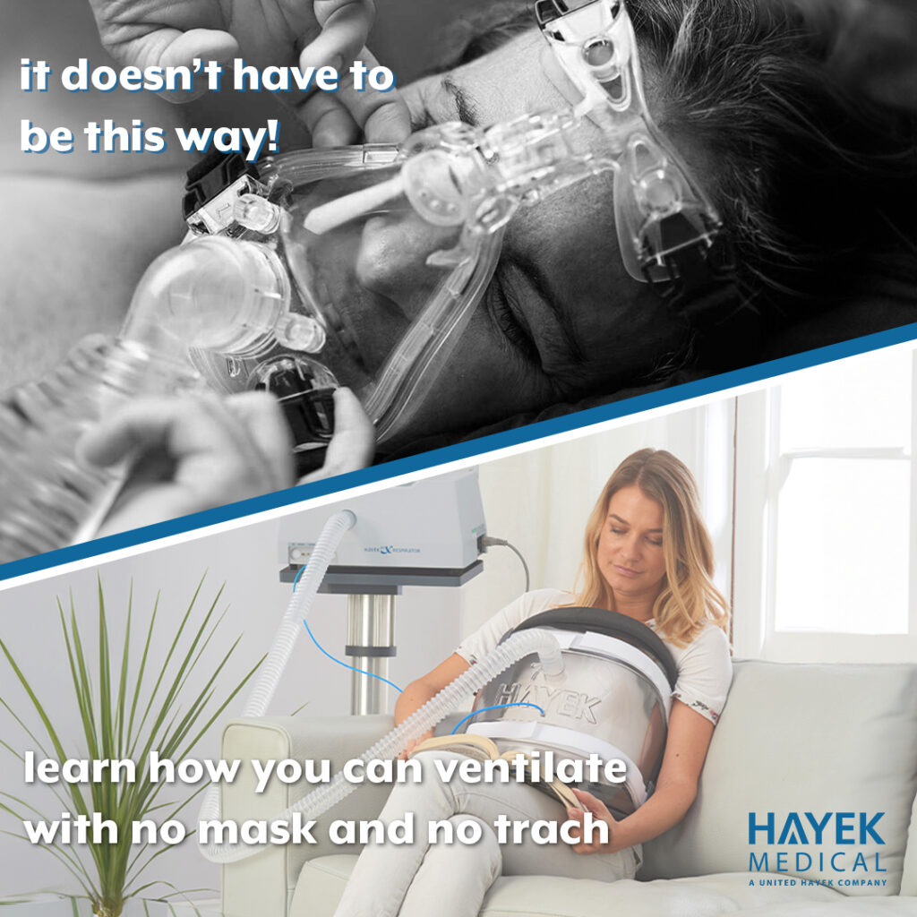 comparison image for ALS patients of a female with a mask ventilator and a BCV